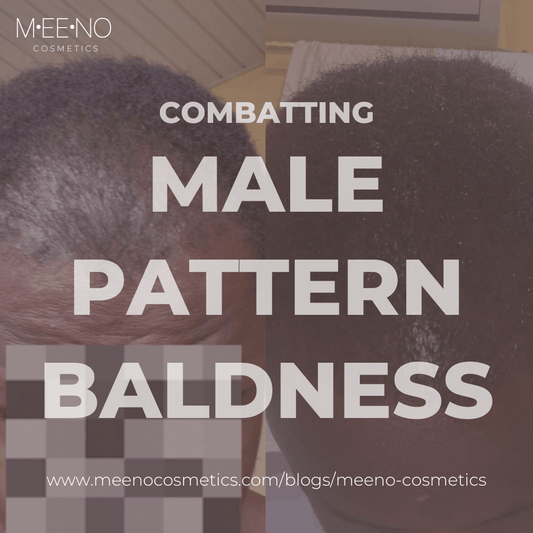 Combatting Male Pattern Baldness - Meeno Cosmetics